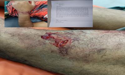 রূপগঞ্জে যাত্রীকে অস্ত্রের মুখে জিম্মি করে সর্বস্ব লুট করে নেয় বাসের হেলপার-চালক